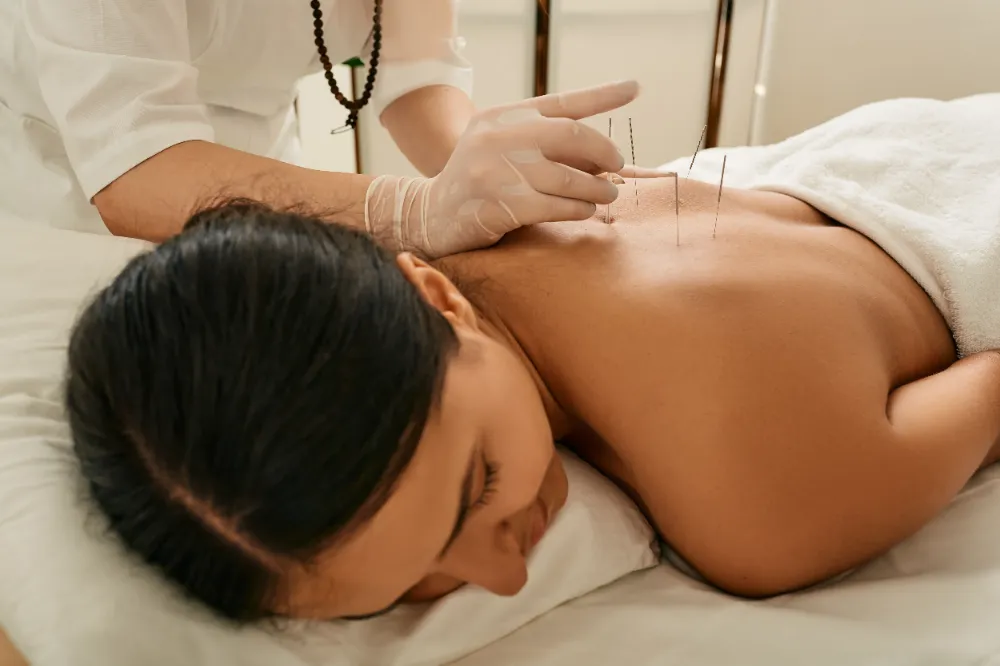 An adult woman relaxing during the acupuncture service.